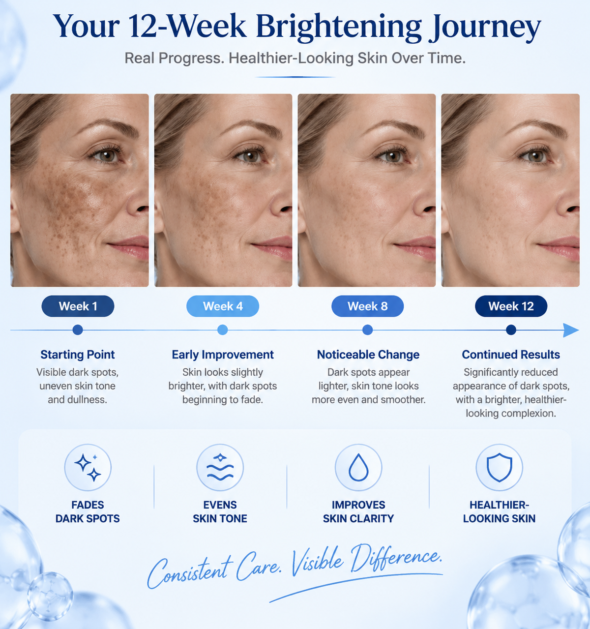 Uneven Skin Tone Solution – Brightening Serum for Dark Spots, Dullness & Texture-CDD