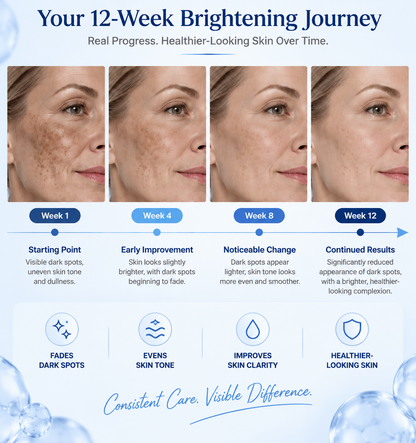 Uneven Skin Tone Solution – Brightening Serum for Dark Spots, Dullness & Texture-CDD