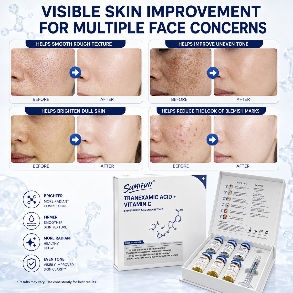 Uneven Skin Tone Solution – Brightening Serum for Dark Spots, Dullness & Texture-CDD
