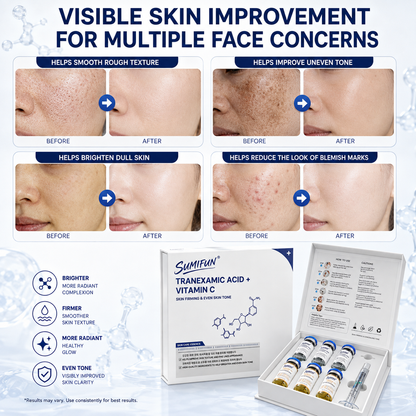 Uneven Skin Tone Solution – Brightening Serum for Dark Spots, Dullness & Texture-CDD