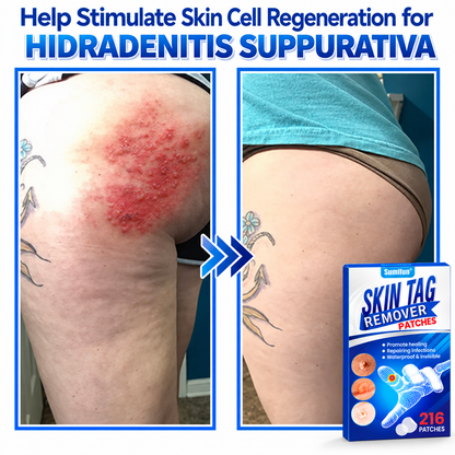 Sumifun® 2-in-1 Hydrocolloid Microneedle Patches-Ll